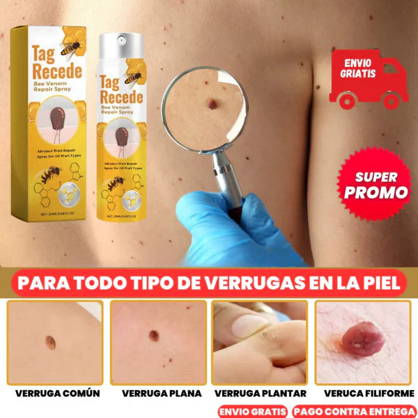 ELIMINADOR DE VERRUGAS