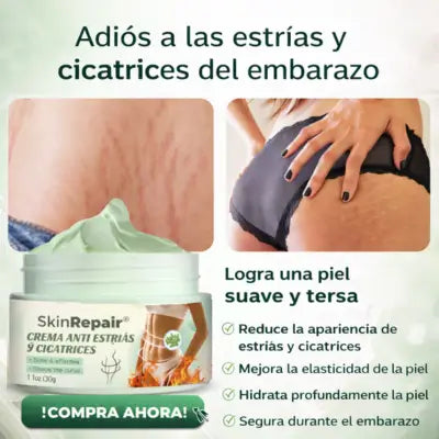 SKINREPAIR® crema anti estrías y cicatrices